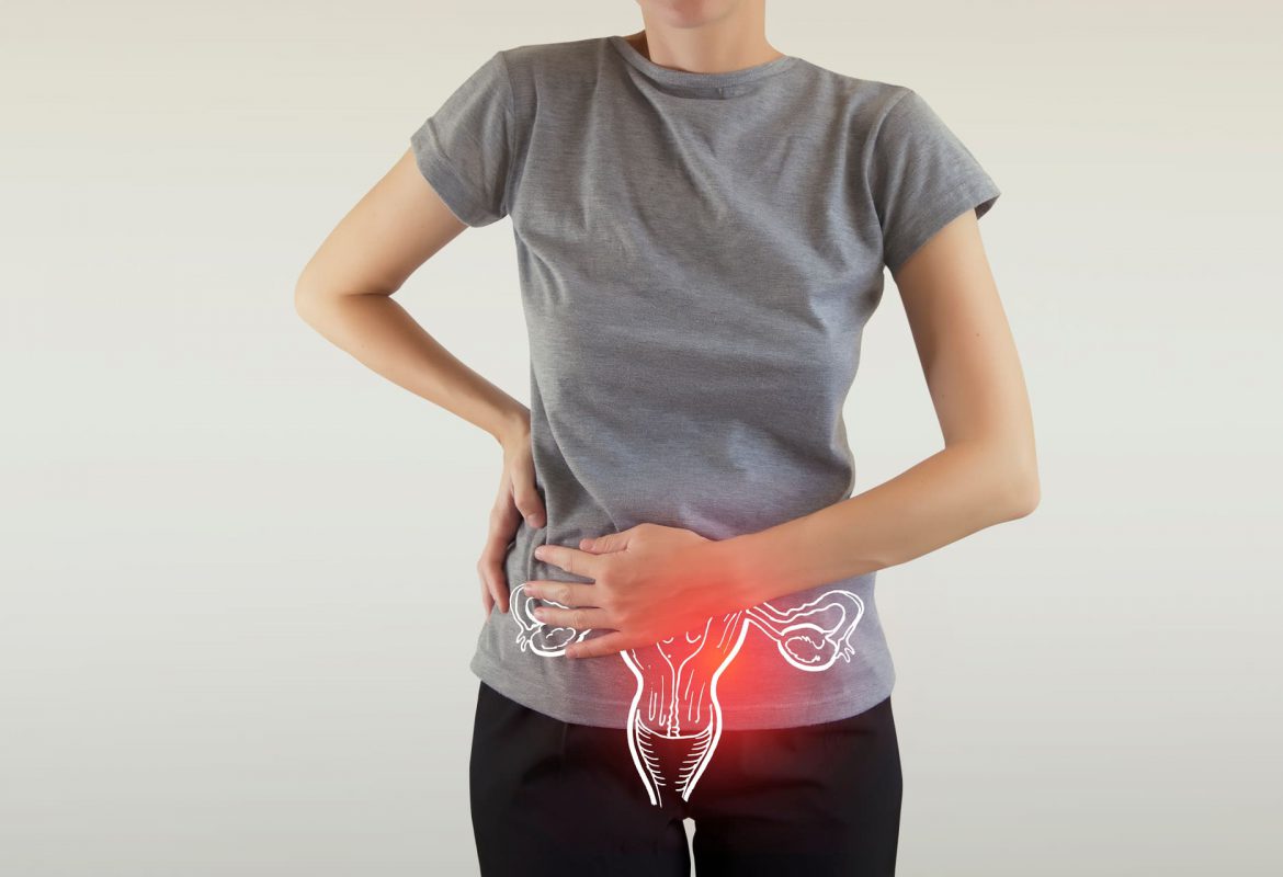Endometriose: causas, sintomas e formas de tratamento