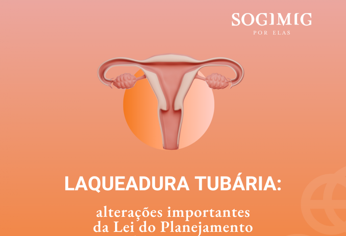 Laqueadura tubária pós-parto vaginal (SOGIMIG)